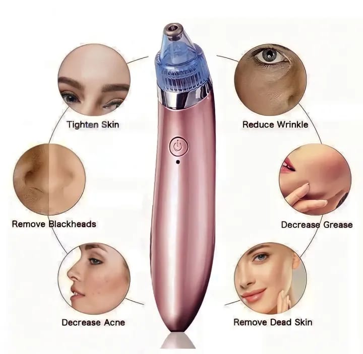 5-in-1 Rechargeable Blackhead Removal Machine – Powerful Pore Cleaner & Vacuum Suction Tool