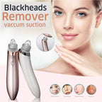 5-in-1 Rechargeable Blackhead Removal Machine – Powerful Pore Cleaner & Vacuum Suction Tool